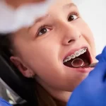young girl at orthodontist