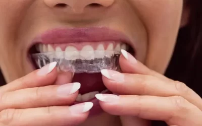 Invisalign Manhattan Beach: Clear Aligner Therapy for Discreet Orthodontic Correction